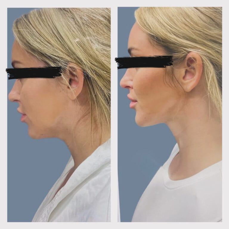 AB2EB478-CA4F-4324-89E7-66A9A2AF1282