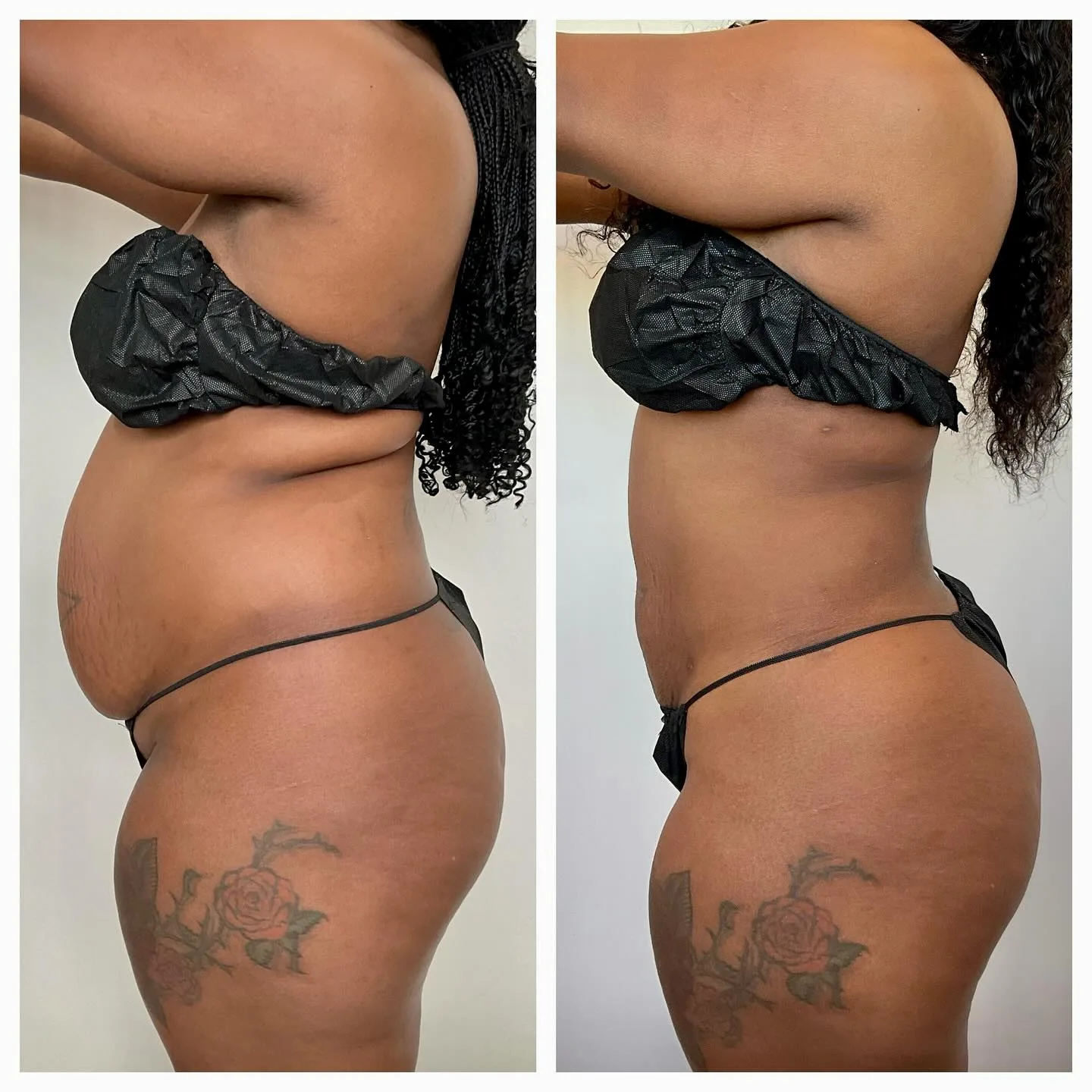 dr.snatched 2024-10-22T145349-1