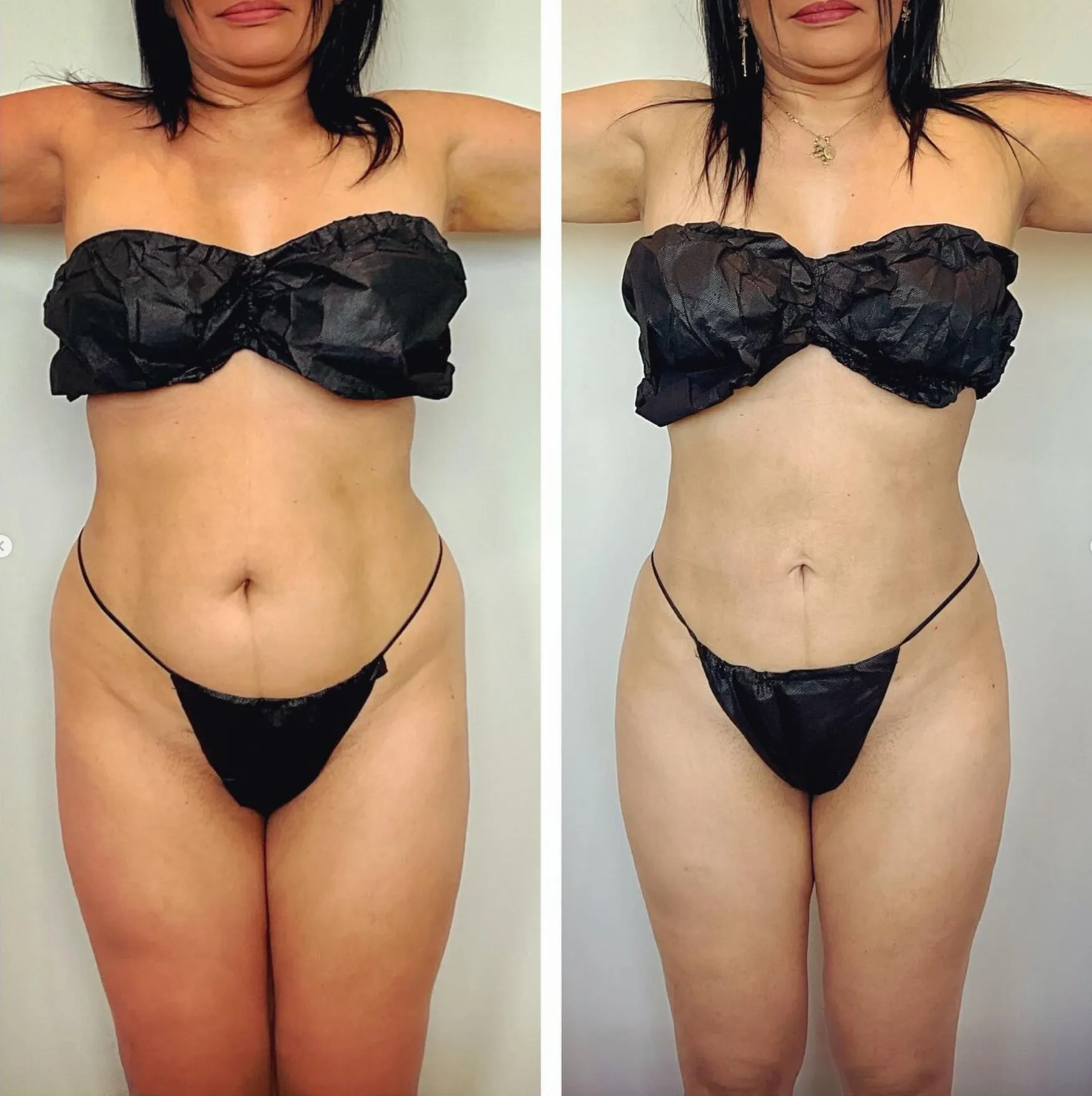 abdomen 22