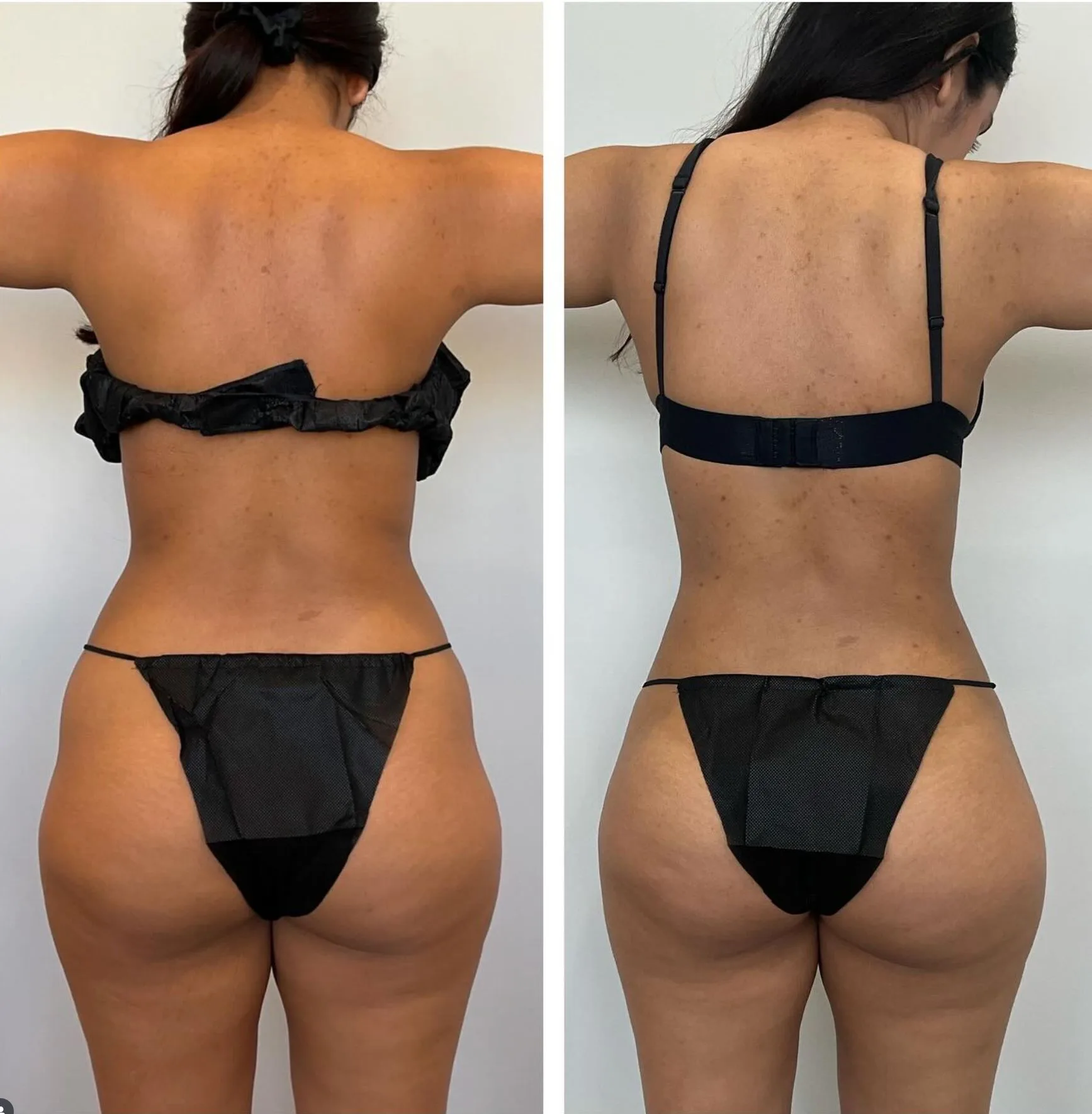 abdomen 31