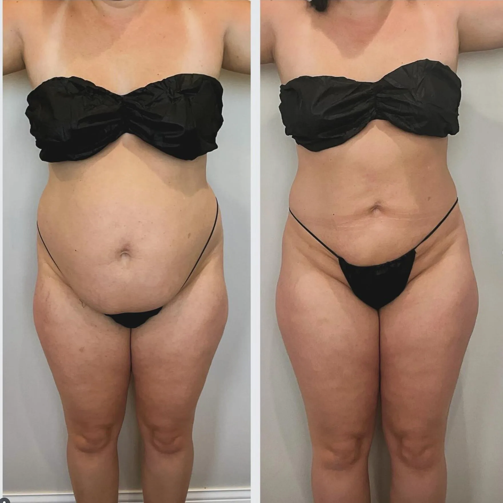 abdomen 41