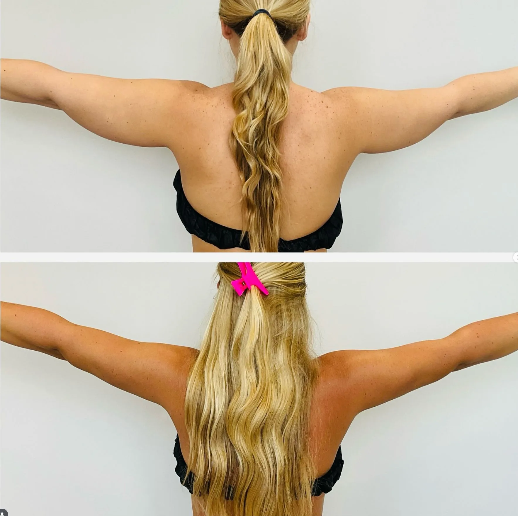 arms
