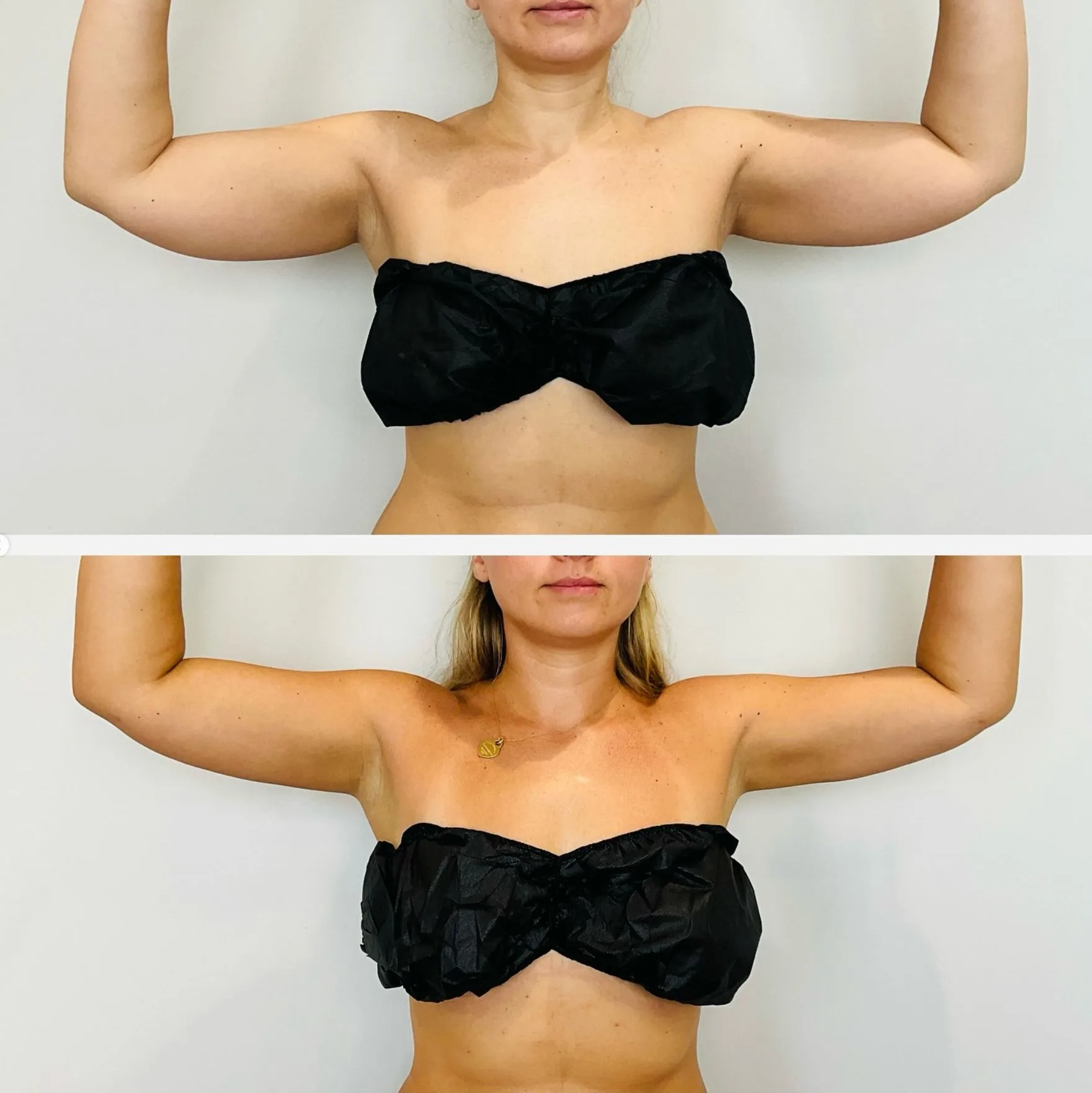 arms4