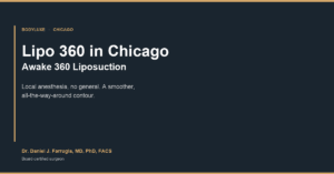 Lipo 360 in Chicago, awake 360 liposuction at BodyLuxe