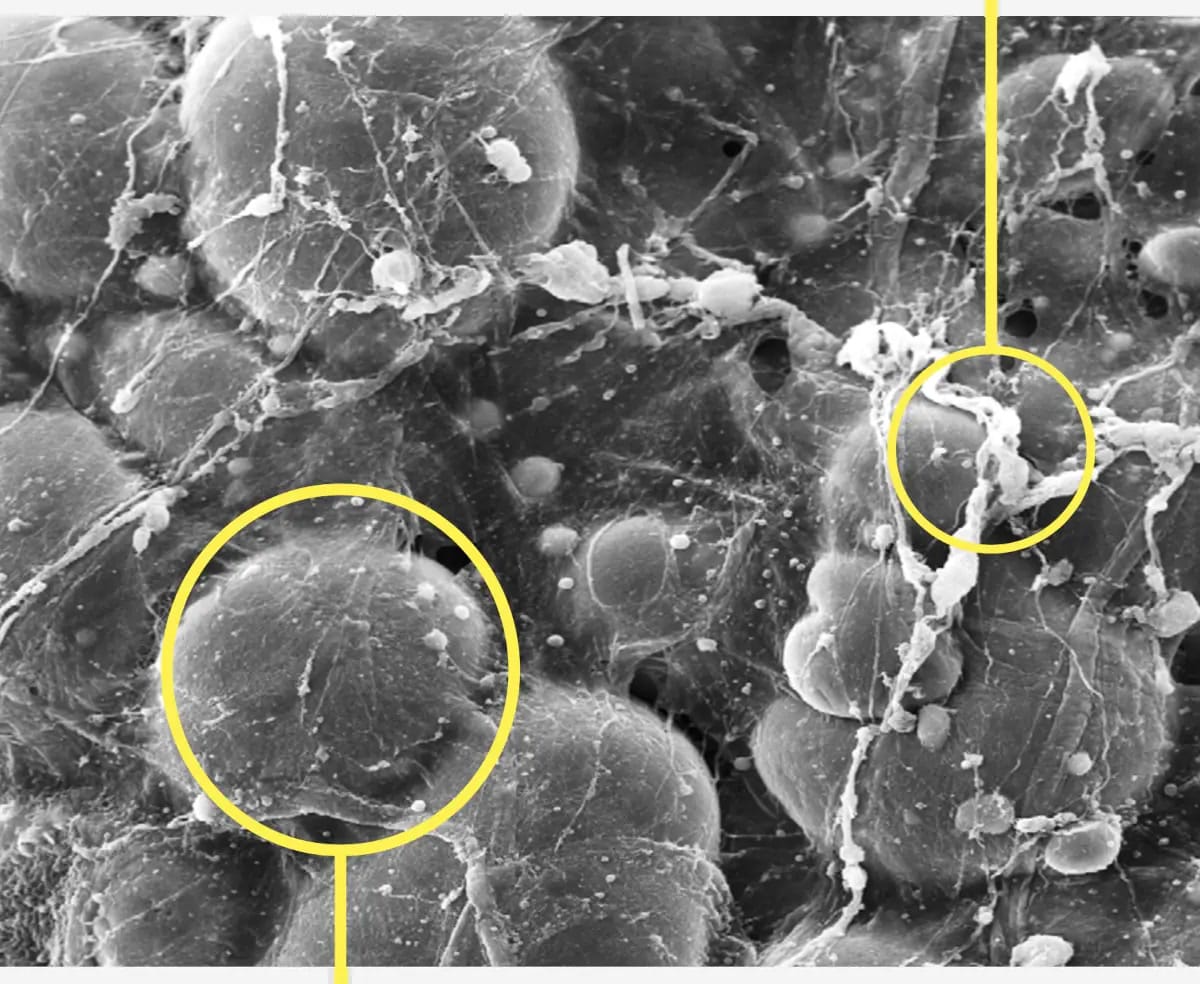 AlloClae structural adipose tissue composed of intact adipocytes and extracellular matrix under magnification