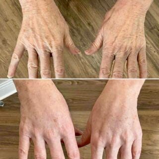 hands front